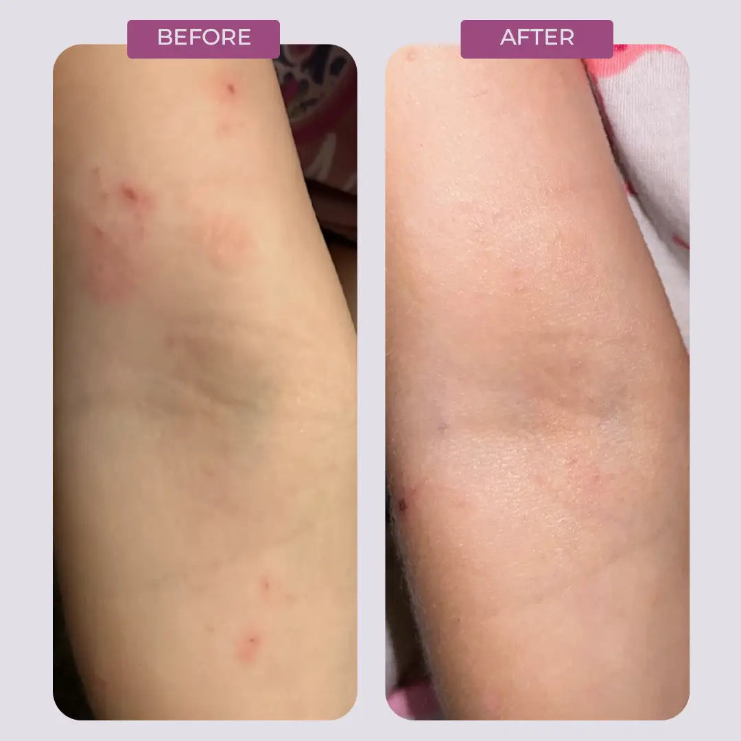 Vegan Salve – Natural Balm for Dry & Cracked Skin – Scentral Zone